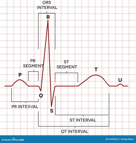 Human Heart Normal Sinus Rhythm, Electrocardiogram Stock Vector - Illustration of life ...