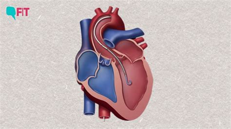 FAQ: What Is the Impella Device? How Is It Saving Lives Of Heart Patients?