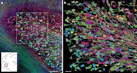 Fluorescent Neurons Over the Brainbow