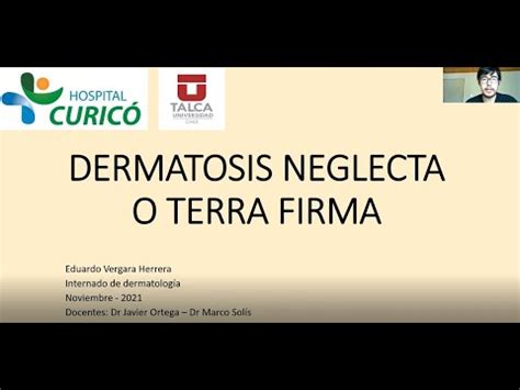 Dermatosis Neglecta - YouTube