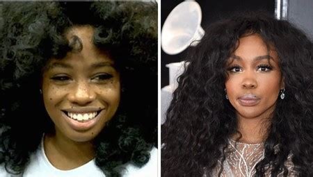 The Untold Truth Of SZA Undergoing Plastic Surgeries