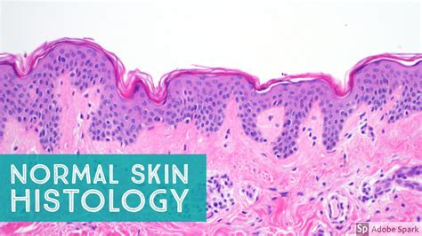 Normal Skin Histology - Explained by a Dermatopathologist - YouTube