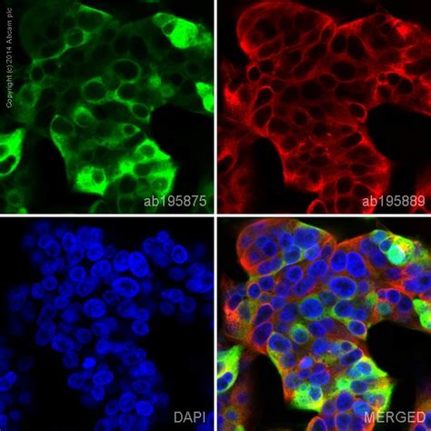 Alexa Fluor® 488 Anti-beta Catenin antibody [12F7] (ab195875) | Abcam