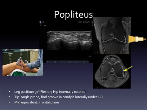 Ultrasound - Knee