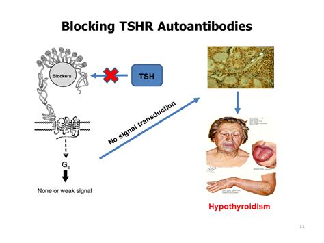 TSH Receptor Antibodies, Clinical Applications and Clinical Relevance