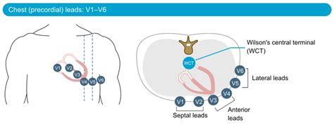 The ECG leads: Electrodes, limb leads, chest (precordial) leads and the 12-Lead ECG – ECG & ECHO