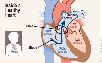 Pulmonary Stenosis (for Parents) | Nemours KidsHealth