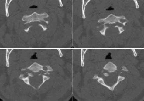 Preoperative axial computed tomography (CT and MRI) images of a... | Download Scientific Diagram