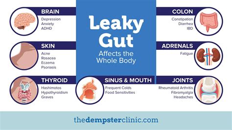 Leaky Gut Syndrome – The Silent Killer - The Dempster Clinic