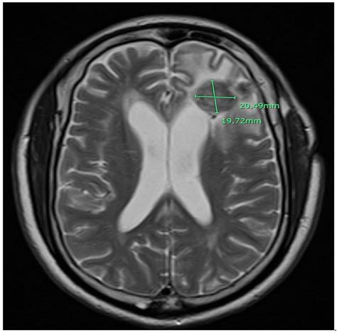 Control magnetic resonance imaging (MRI) of the brain with gadolinium... | Download Scientific ...