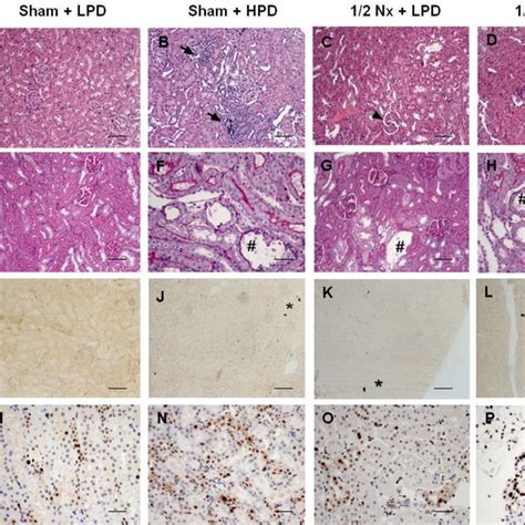 Excessive phosphaturia promotes renal injury. Renal samples from Sham +... | Download Scientific ...