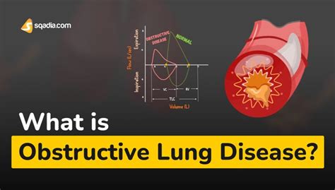 What is Obstructive Lung Disease?