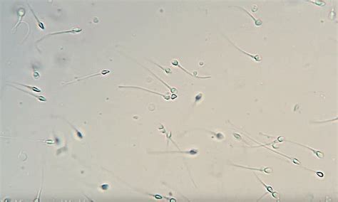 Human Sperm Under Microscope