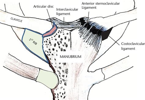 Swellings of the sternoclavicular joint: review of traumatic and non-traumatic pathologies in ...