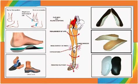 Black Leather Ucbl Orthosis Custom Shoe Inserts By Mycaremedical ...