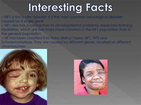 PPT - Neurofibromatosis 1 PowerPoint Presentation, free download - ID:2160011