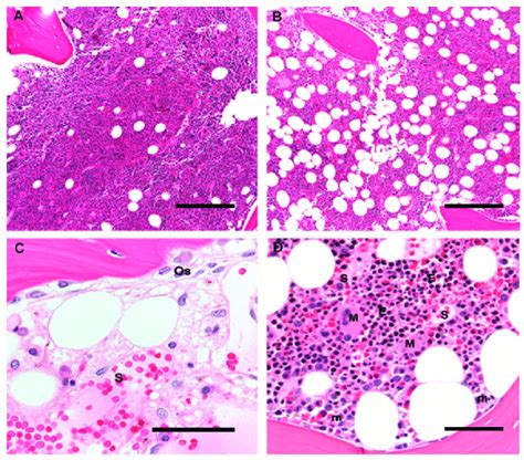 Bone Marrow: Composition and Hematopoiesis | Concise Medical Knowledge