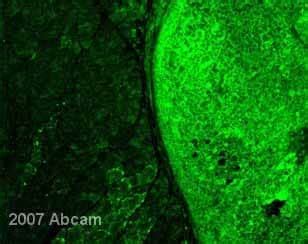 Anti-GFP antibody (ab13970) | Abcam