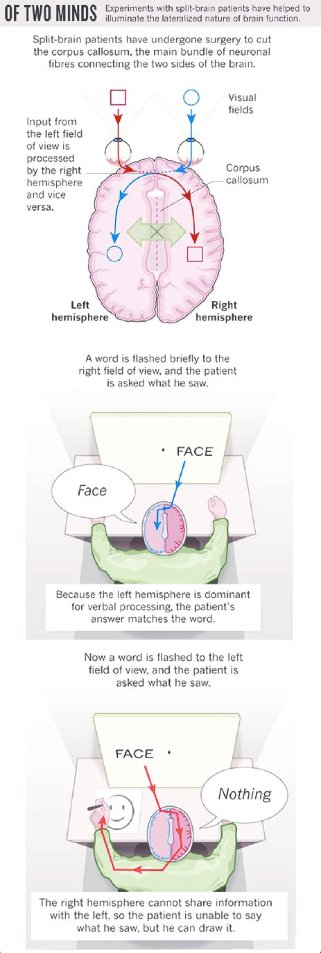 The split brain patient and consciousness [Author's note: Taken from ...