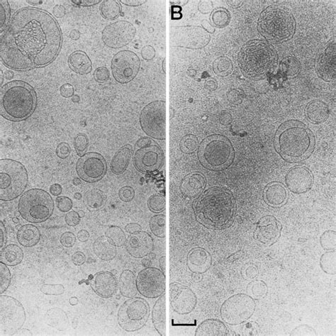 pH dependency of the respiration of Picrophilus oshimae. Cells of P.... | Download Scientific ...