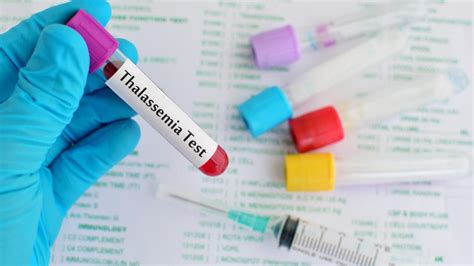 Thalassemia: Types, Diagnosis and Treatment - MedClique