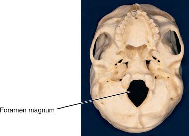 Foramen magnum