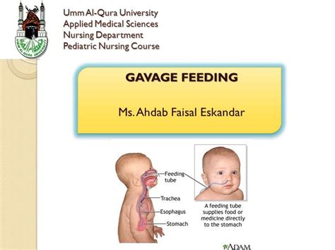 Image result for gavage feeding | Pediatric nursing, Pediatrics ...