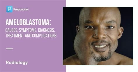 Ameloblastoma: Causes, Symptoms, Diagnosis, Treatment and Complications