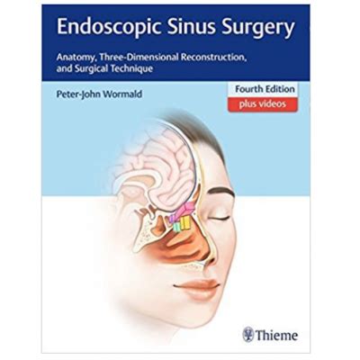Endoscopic Sinus Surgery: Anatomy, Three-Dimensional Reconstruction, And Surgical Technique;4th ...