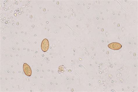 Medical Laboratory and Biomedical Science: Parasites in human faeces