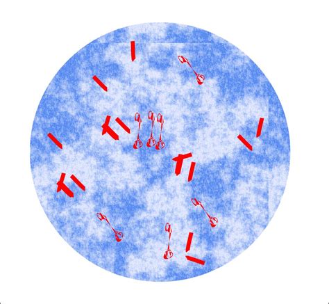 Tuberculosis Acid Fast Stain