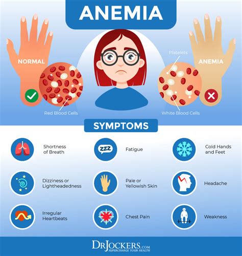 Anemia Hands