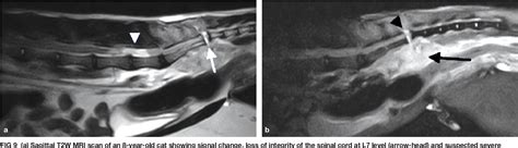 Figure 9 from Acute Spinal Cord Injury in the Cat: Causes, Treatment ...