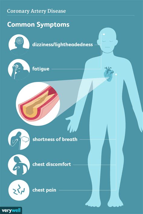 Coronary Artery Disease: Signs, Symptoms, and Complications