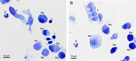 Cells Seen In Bronchoalveolar Lavage