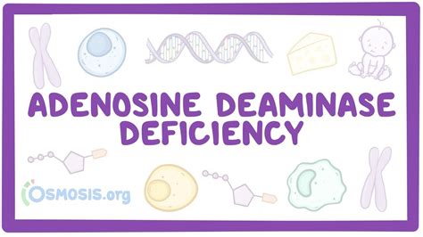 Adenosine deaminase deficiency: Video, Causes, & Meaning | Osmosis