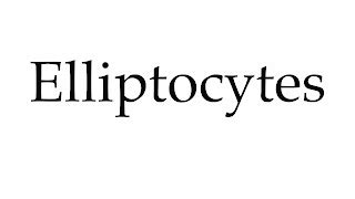 Hello USA: elliptocytes