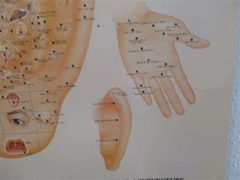 Acupuncture Wall Chart Poster #4 China Cultural Corp. Vintage 1981 21"x44" | #4552247144