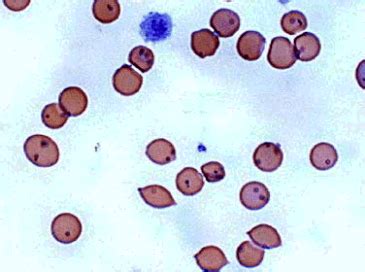 LankaVet: Haemobartonellosis in Dos & Cats - Hemotrophic Mycoplasmosis