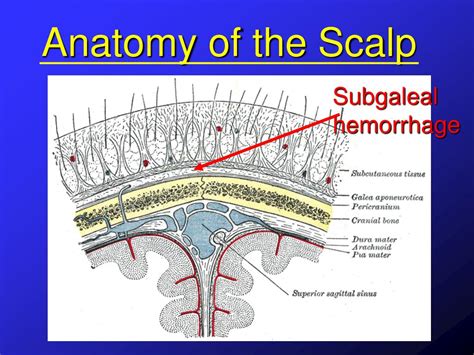 PPT - Lumps & Bumps on the Newborn Head. When should I worry? PowerPoint Presentation - ID:3127034