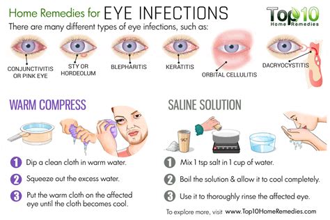 Home Remedies for Eye Infections | Top 10 Home Remedies