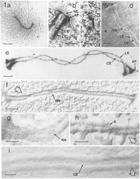 Comparisons of synaptonemal complex substructures visualized by surface ...