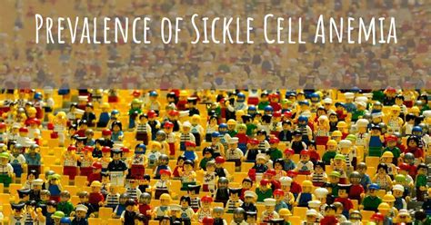 What is the prevalence of Sickle Cell Anemia?