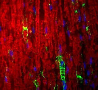 Myelin Protein Zero Antibody (NB100-1607): Novus Biologicals