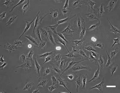 Phase Contrast Microscopy | Principle and Applications | ibidi