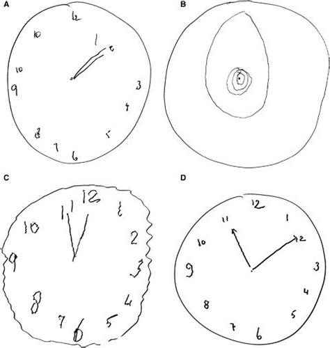 Clock-Drawing Test to Diagnose Alzheimer's - Sisters Hospitallers CIO