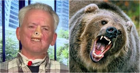 Hunter Who Lost His Nose After Grizzly Bear Attack Builds A New One On ...