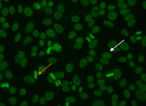 Dense fine speckled pattern. Mitotic cells (orange arrow) show a fine... | Download Scientific ...