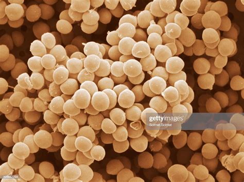 Staphylococcus Saprophyticus Is A Coagulase And Phosphatasenegative ...