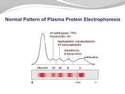 Image result for normal serum protein electrophoresis | Serum, Biochemistry, Protein